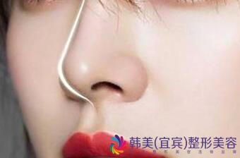 �˱������ͷԲ��ʺ��ԭ����Ҫ��