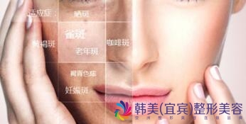 �˱�����Ƥ�뼤�����