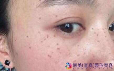 �˱��ƺְ�����Ӱ��Ƥ�����ݵ�Ƥ����