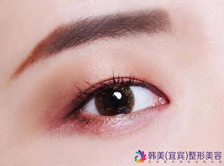 �˱�����ȥ�۴�ʹ��