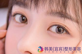 �˱������������۴���Ҫ����Ǯ?