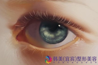 �˱��粨��Ƥ���۴�