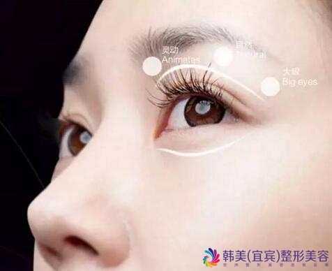 �˱���ʽ΢��˫��Ƥ�ɹ�����ߵ����ļ���